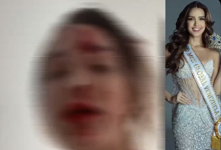 ( Vidéo ) 	Cannes : visage en sang, plainte déposée et offres pour se taire refusées, l’affaire Miss Venezuela secoue le Festival